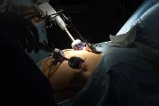 Foto av en gastric bypass-operation på ett sjukhus.