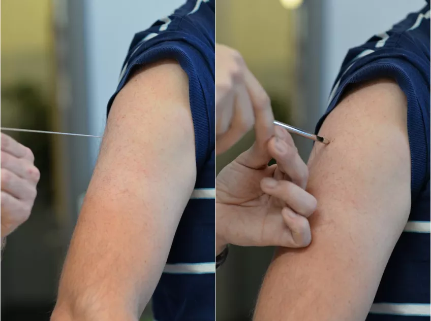 Foto av två olika biopsinålar för muskelfiberbestämning. Bildmontage.